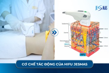 HIFU Giảm Mỡ Có Hiệu Quả Không? Sự Thật Ít Ai Biết Về Công Nghệ HIFU Body