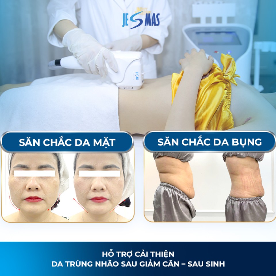 Công Nghệ Máy Chăm Sóc Trẻ Hóa Da HIFU Jesmas