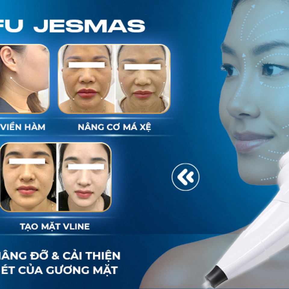 Ưu điểm HIFU Jesmas - cải tiến – Giảm đau, tăng tính linh hoạt