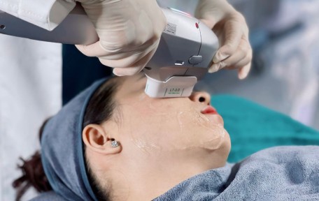 Nâng cơ HIFU là gì? Ứng dụng trong trẻ hóa da không xâm lấn hiện đại