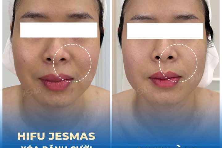 Chị Thanh Hà Nội