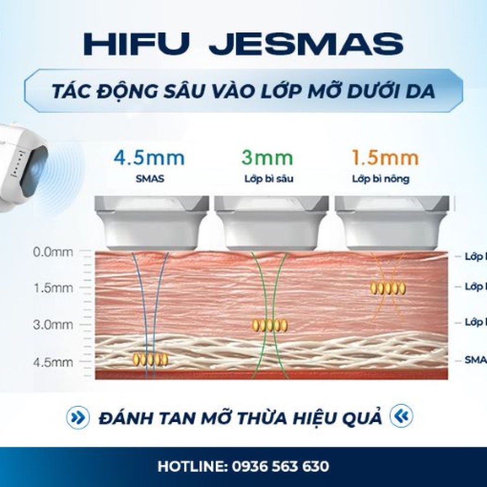 Ưu điểm HIFU Jesmas - cải tiến – Giảm đau, tăng tính linh hoạt