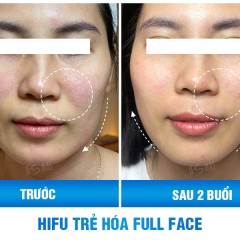 Ms Thanh - Khách hàng  tại Hà Nội 