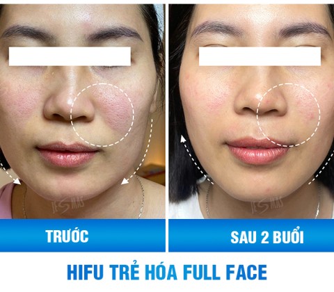 Ms Thanh - Khách hàng  tại Hà Nội 