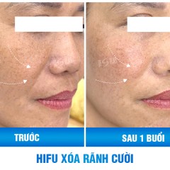 Ms Phương Phương