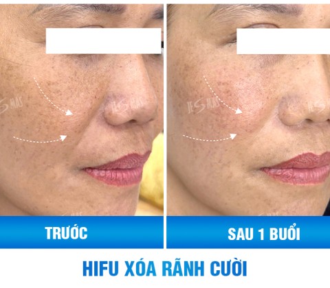 Ms Phương Phương