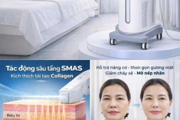 HIFU giữ được bao lâu? Bao lâu cần làm lại?