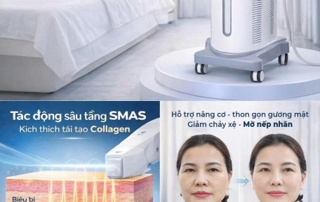 HIFU giữ được bao lâu? Bao lâu cần làm lại?