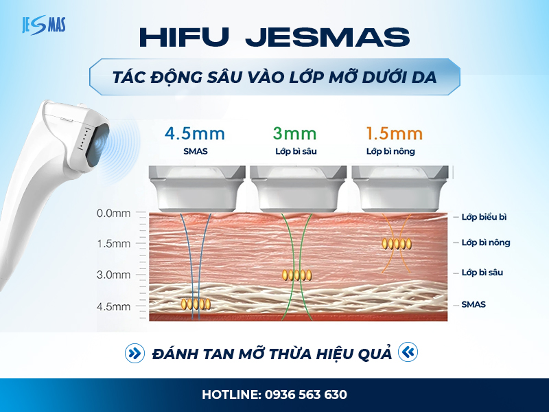 Máy Hifu cao cấp jesmas