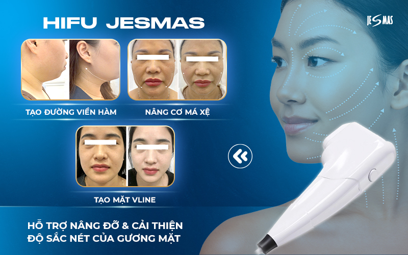 co chế hoạt động hifu