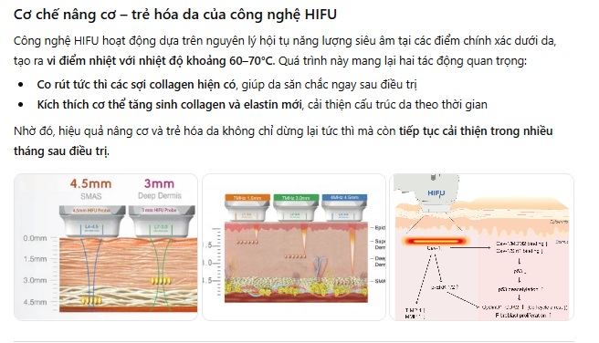 Ứng dụng của nâng cơ HIFU trong trẻ hóa da